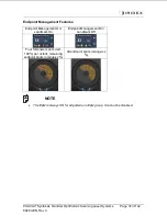 Preview for 72 page of Iridex PASCAL Synthesis TwinStar Operator'S Manual