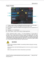 Preview for 79 page of Iridex PASCAL Synthesis TwinStar Operator'S Manual