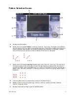 Preview for 15 page of Iridex TxCell SSLA Operator'S Manual