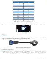 Предварительный просмотр 14 страницы Iriss Sonus PD Pro Operating Manual