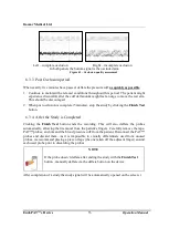 Предварительный просмотр 59 страницы Itamar Medical EndoPAT 2000 Operation Manual