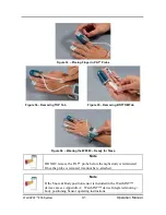 Preview for 49 page of Itamar Medical WatchPAT 200 Unified Operation Manual