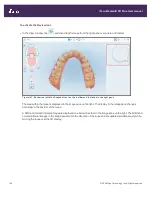 Preview for 164 page of iTero Element 5D Plus User Manual