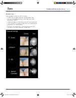 Preview for 24 page of iTero Element 5D Instructions For Use Manual