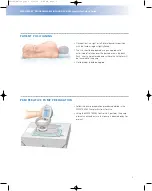 Preview for 5 page of Johnson & Johnson Codman MedStream Surgical Technique Manual