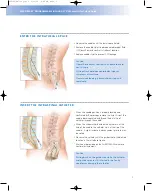 Preview for 7 page of Johnson & Johnson Codman MedStream Surgical Technique Manual