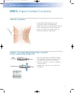 Preview for 15 page of Johnson & Johnson Codman MedStream Surgical Technique Manual