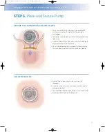 Preview for 17 page of Johnson & Johnson Codman MedStream Surgical Technique Manual