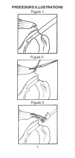 Preview for 2 page of Johnson & Johnson DePuy Mitek BIOKNOTLESS RC ANCHOR Manual