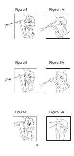 Preview for 4 page of Johnson & Johnson DePuy Mitek Rigidfix 104144 Manual