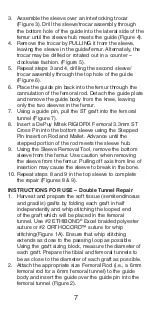 Preview for 8 page of Johnson & Johnson DePuy Mitek Rigidfix 104144 Manual