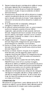 Preview for 14 page of Johnson & Johnson DePuy Mitek Rigidfix 104144 Manual