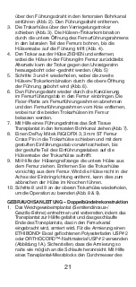 Preview for 22 page of Johnson & Johnson DePuy Mitek Rigidfix 104144 Manual