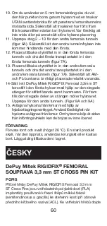 Preview for 61 page of Johnson & Johnson DePuy Mitek Rigidfix 104144 Manual