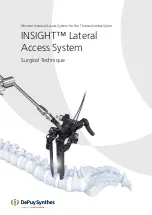 Johnson & Johnson DePuy Synthes INSIGHT Lateral Access System Manual preview