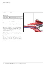 Preview for 12 page of Johnson & Johnson DePuy Synthes INSIGHT Lateral Access System Manual