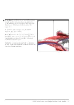 Preview for 13 page of Johnson & Johnson DePuy Synthes INSIGHT Lateral Access System Manual