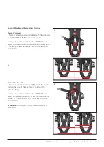 Preview for 19 page of Johnson & Johnson DePuy Synthes INSIGHT Lateral Access System Manual