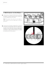 Preview for 20 page of Johnson & Johnson DePuy Synthes INSIGHT Lateral Access System Manual