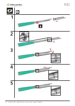 Preview for 42 page of Johnson & Johnson DePuy Synthes INSIGHT Lateral Access System Manual