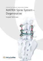 Preview for 1 page of Johnson & Johnson DePuy Synthes MATRIX Surgical Technique