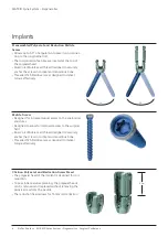 Preview for 6 page of Johnson & Johnson DePuy Synthes MATRIX Surgical Technique