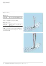 Preview for 18 page of Johnson & Johnson DePuy Synthes MATRIX Surgical Technique