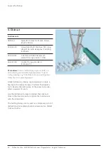 Preview for 26 page of Johnson & Johnson DePuy Synthes MATRIX Surgical Technique