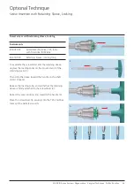 Preview for 31 page of Johnson & Johnson DePuy Synthes MATRIX Surgical Technique