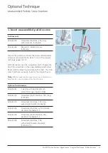 Preview for 33 page of Johnson & Johnson DePuy Synthes MATRIX Surgical Technique