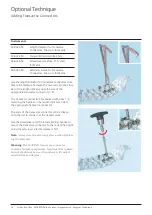 Preview for 38 page of Johnson & Johnson DePuy Synthes MATRIX Surgical Technique