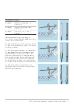 Preview for 43 page of Johnson & Johnson DePuy Synthes MATRIX Surgical Technique