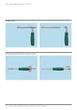 Preview for 50 page of Johnson & Johnson DePuy Synthes MATRIX Surgical Technique