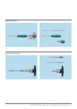 Preview for 51 page of Johnson & Johnson DePuy Synthes MATRIX Surgical Technique