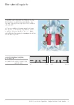 Preview for 83 page of Johnson & Johnson DePuy Synthes MATRIX Surgical Technique