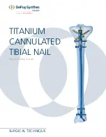 Preview for 1 page of Johnson & Johnson DePuy Synthes TRAUMA Titanium Cannulated Tibial Nail Surgical Technique