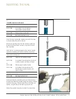 Preview for 16 page of Johnson & Johnson DePuy Synthes TRAUMA Titanium Cannulated Tibial Nail Surgical Technique