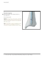 Preview for 19 page of Johnson & Johnson DePuy Synthes TRAUMA Titanium Cannulated Tibial Nail Surgical Technique