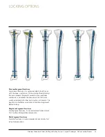 Preview for 20 page of Johnson & Johnson DePuy Synthes TRAUMA Titanium Cannulated Tibial Nail Surgical Technique