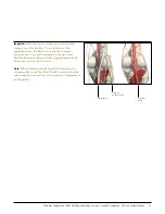 Preview for 36 page of Johnson & Johnson DePuy Synthes TRAUMA Titanium Cannulated Tibial Nail Surgical Technique