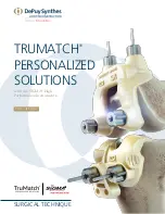 Preview for 1 page of Johnson & Johnson Depuy Synthes Trumatch Surgical Technique