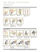 Preview for 3 page of Johnson & Johnson Depuy Synthes Trumatch Surgical Technique