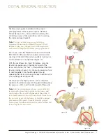 Preview for 7 page of Johnson & Johnson Depuy Synthes Trumatch Surgical Technique