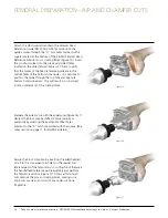 Preview for 10 page of Johnson & Johnson Depuy Synthes Trumatch Surgical Technique