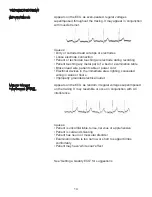 Preview for 17 page of JORGENSEN J1010 Manual