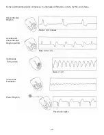 Preview for 23 page of JORGENSEN J1010 Manual