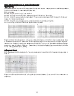 Preview for 29 page of JORGENSEN J1010 Manual