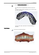 Предварительный просмотр 79 страницы KaVo ProXam iOS Instructions For Use Manual