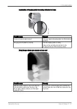 Preview for 61 page of KaVo ProXam iP Instructions For Use Manual