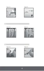 Preview for 5 page of KERR EndoVac Instructions For Use Manual